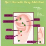 Eastern auricular medicine quict narcotic drug addiction book by Dr Li Chun Huang